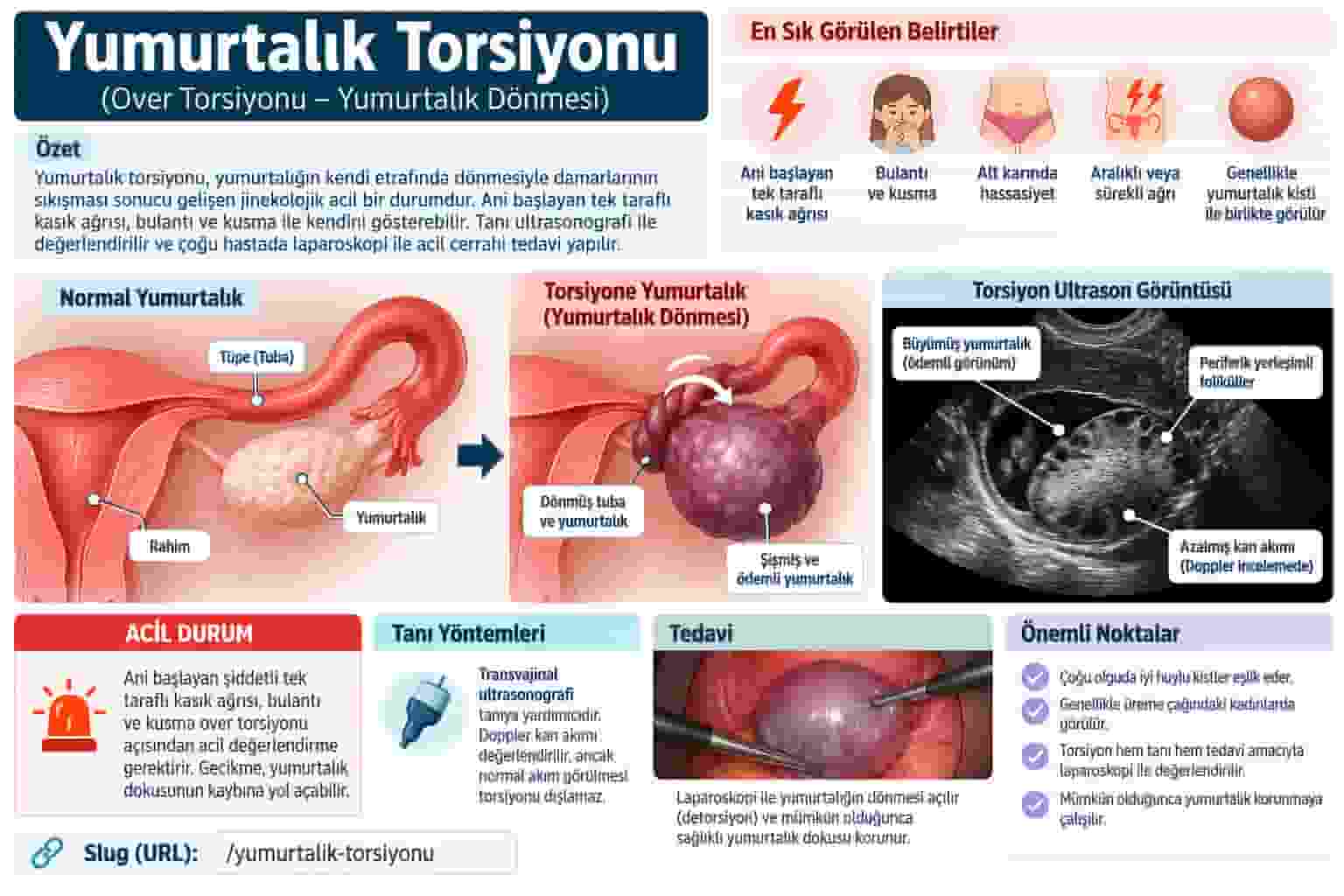 Over Torsiyonu (Yumurtalık Dönmesi): Ani Kasık Ağrısında Acil Müdahale
