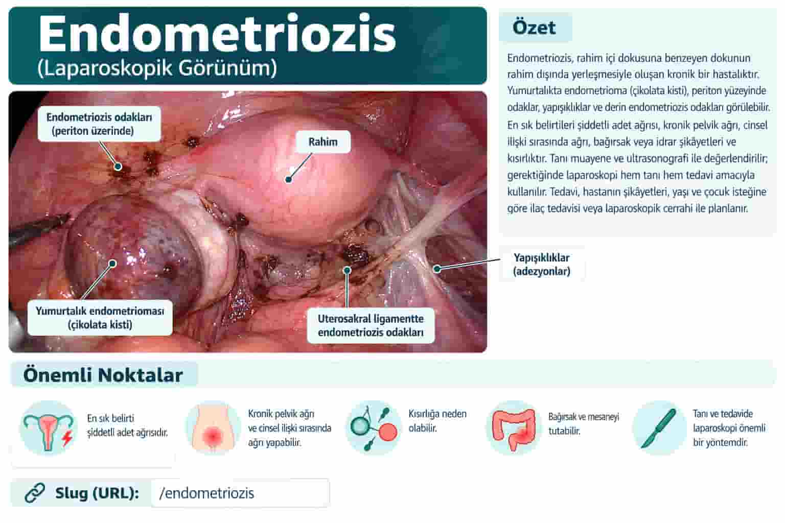 Endometriozis Tedavisi: İlaç Tedavisi, Çikolata Kisti Ameliyatı ve Laparoskopik Cerrahi