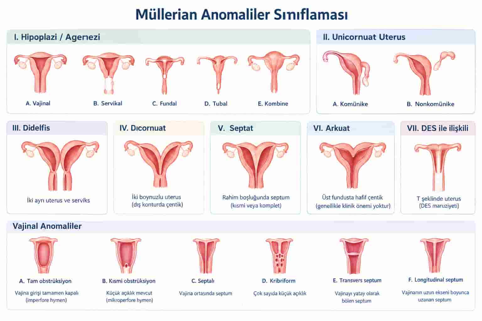 Rahim Anomalileri (Müllerian Anomaliler): Türleri, Belirtileri, Tanı ve Tedavisi